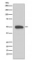 Anti-Cytokeratin 13 Rabbit Monoclonal Antibody