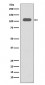 Anti-Integrin beta 3 ITGB3 Rabbit Monoclonal Antibody