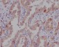 Anti-Catenin alpha 1 CTNNA1 Rabbit Monoclonal Antibody