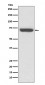 Anti-TNF Receptor II TNFRSF1B Rabbit Monoclonal Antibody