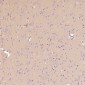 Anti-Integrin alpha V ITGAV Rabbit Monoclonal Antibody