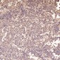 Anti-Integrin alpha V ITGAV Rabbit Monoclonal Antibody