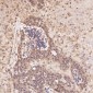 Anti-Integrin alpha V ITGAV Rabbit Monoclonal Antibody