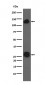 Anti-Integrin alpha V ITGAV Rabbit Monoclonal Antibody