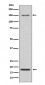 Anti-Integrin alpha 5 ITGA5 Rabbit Monoclonal Antibody