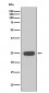 Anti-Interferon gamma IFNG Rabbit Monoclonal Antibody