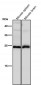 Anti-Interferon gamma IFNG Rabbit Monoclonal Antibody