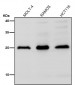 Anti-Interferon gamma IFNG Rabbit Monoclonal Antibody