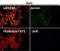 Anti-Integrin alpha V ITGAV Rabbit Monoclonal Antibody