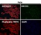 Anti-Integrin alpha V ITGAV Rabbit Monoclonal Antibody