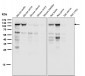 Anti-Androgen Receptor AR Rabbit Monoclonal Antibody