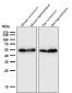 Anti-p53 (acetyl K370) TP53 Rabbit Monoclonal Antibody