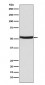 Anti-p53 (acetyl K382) TP53 Rabbit Monoclonal Antibody