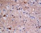 Anti-ATP citrate lyase ACLY Rabbit Monoclonal Antibody