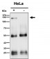 Anti-ATP citrate lyase ACLY Rabbit Monoclonal Antibody