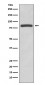 Anti-Glycogen synthase GYS1 Rabbit Monoclonal Antibody