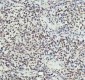 Anti-PIAS1+PIAS2+PIAS3 Rabbit Monoclonal Antibody