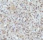 Anti-PIAS1+PIAS2+PIAS3 Rabbit Monoclonal Antibody