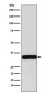 Anti-gamma Sarcoglycan Rabbit Monoclonal Antibody