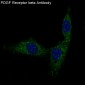 Anti-PDGF Receptor beta PDGFRB Rabbit Monoclonal Antibody
