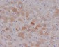 Anti-C Reactive Protein CRP Rabbit Monoclonal Antibody