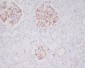 Anti-Mast Cell Tryptase Rabbit Monoclonal Antibody