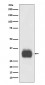 Anti-Mast Cell Tryptase Rabbit Monoclonal Antibody