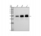 Anti-Thymidine Kinase 1 Rabbit Monoclonal Antibody