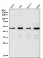 Anti-Lipoprotein lipase LPL Rabbit Monoclonal Antibody