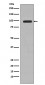 Anti-PI 3 Kinase Class 3 PIK3C3 Rabbit Monoclonal Antibody