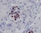 Anti-Wilms Tumor Protein WT1 Rabbit Monoclonal Antibody