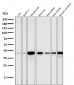 Anti-Glutamine Synthetase GLUL Rabbit Monoclonal Antibody