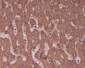 Anti-Alkaline Phosphatase ALPL Rabbit Monoclonal Antibody