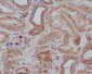 Anti-Tyrosine Hydroxylase TH Rabbit Monoclonal Antibody