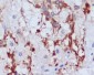 Anti-PI 3 Kinase p55 gamma PIK3R3 Rabbit Monoclonal Antibody