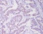 Anti-Topoisomerase II alpha TOP2A Rabbit Monoclonal Antibody
