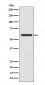 Anti-Cytokeratin 5 (C-term) KRT5 Rabbit Monoclonal Antibody