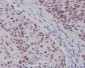 Anti-Estrogen Receptor beta ESR2 Rabbit Monoclonal Antibody