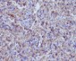 Anti-Hemoglobin subunit alpha HBA1 Rabbit Monoclonal Antibody