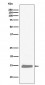 Anti-Hemoglobin subunit alpha HBA1 Rabbit Monoclonal Antibody