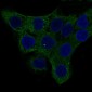 Anti-alpha smooth muscle Actin ACTA2 Rabbit Monoclonal Antibody