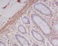 Anti-alpha smooth muscle Actin ACTA2 Rabbit Monoclonal Antibody