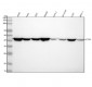 Anti-alpha smooth muscle Actin ACTA2 Rabbit Monoclonal Antibody