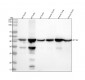 Anti-alpha smooth muscle Actin ACTA2 Rabbit Monoclonal Antibody