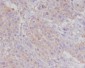 Anti-alpha smooth muscle Actin ACTA2 Rabbit Monoclonal Antibody