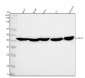 Anti-alpha smooth muscle Actin ACTA2 Rabbit Monoclonal Antibody