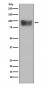 Anti-Interferon Receptor alpha IFNAR1 Rabbit Monoclonal Antibody