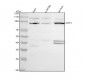 Anti-Transferrin Receptor (CD71) TFRC Rabbit Monoclonal Antibody