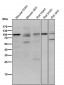 Anti-delta 1 Catenin/p120 Catenin Rabbit Monoclonal Antibody