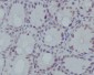 Anti-Histone H3 (mono methyl R17) HIST1H3A Rabbit Monoclonal Antibody